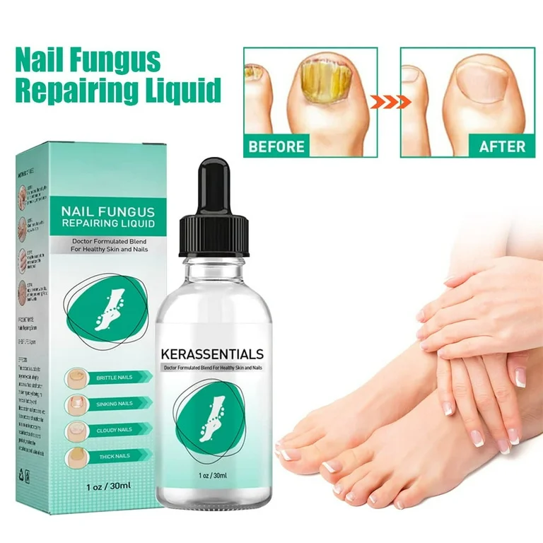 Kerassentials nail repairing liquid bottle with box, botanicals and well-maintained hands and feet